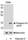 Western blot analysis of lysate from HeLa cell line, untreated or treated with Calyculin A (100ng/ml), using phospho-Histone H3 antibody