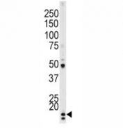 Western blot testing of p-p21 antibody and HeLa lysate.