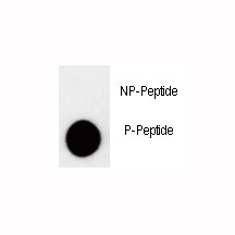 Dot blot analysis of phospho-p27Kip1 antibody. 50ng of phos-peptide or nonphos-peptide per dot were spotted.~