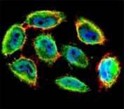 Confocal immunofluorescent analysis of phospho-p53 antibody with A2058 cells followed by Alexa Fluor 488-conjugated goat anti-rabbit lgG (green). Actin filaments labeled with Alexa Fluor 555 Phalloidin (red). DAPI used as a nuclear counterstain (blue)