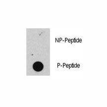 Dot blot analysis of phospho-Rb antibody. 50ng of phos-peptide or nonphos-peptide per dot were spotted.~