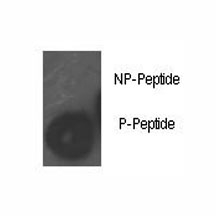 Dot blot analysis of phospho-Rb antibody. 50ng of phos-peptide or nonphos-peptide per dot were spotted.~