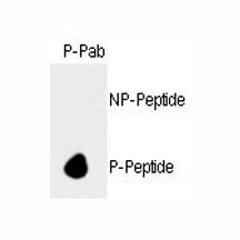Dot blot analysis of phospho-Rb antibody. 50ng of nonphos-peptide or phos-peptide were adsorbed on their respective dots.~