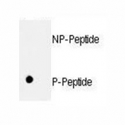 Dot blot analysis of p-Rb1 antibody. 50ng of nonphos-peptide or phos-peptide were adsorbed on their respective dots.