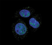Confocal immunofluorescent analysis of p-Rb1 antibody with HepG2 cells followed by Alexa Fluor 488-conjugated goat anti-rabbit lgG (green). DAPI was used as a nuclear counterstain (blue).
