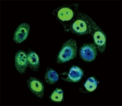 Confocal immunofluorescent analysis of phospho-SMAD4 antibody with HeLa cells followed by Alexa Fluor 488-conjugated goat anti-rabbit lgG (green). DAPI was used as a nuclear counterstain (blue).