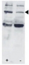 Western blot testing of p-STAT3 antibody and HL-60 cells/lysate collected before (-) or after (+) stimulation with IFN-a.