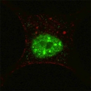 Fluorescent confocal image of SY5Y cells stained with p-STAT3 antibody at 1:200. Note the highly specific localization of the immunosignal to the nucleus.