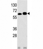 Western blot analysis of S6K antibody and 293 lysate transiently transfected with the RPS6KB1 gene (2ug/lane).