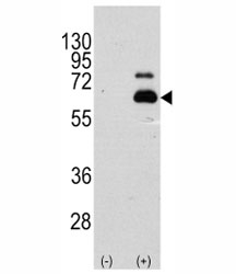 Western blot analysis of p70 S6 Kinase antibody and 293 cell lysate (2 ug/lane) either nontransfected (Lane 1) or transiently transfected with the RPS6KB1 gene (2). Predicted molecular weight: 60-70 kDa