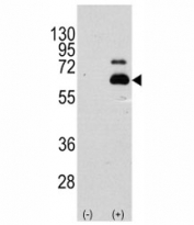 Western blot analysis of p70 S6 Kinase antibody and 293 cell lysate (2 ug/lane) either nontransfected (Lane 1) or transiently transfected with the RPS6KB1 gene (2). Predicted molecular weight: 60-70 kDa