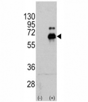 Western blot analysis of p70S6K antibody and 293 cell lysate (2 ug/lane) either nontransfected (Lane 1) or transiently transfected with the RPS6KB1 gene (2).