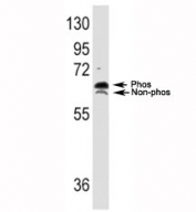 Western blot analysis of p70S6K antibody and TNF alpha activated HeLa lysate; both phospho and non-phos S6K can be detected with this Ab. Predicted molecular weight: 60-70 kDa
