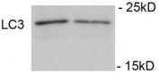 Immunoblots of SH-SY5Y cells treated with rapamycin for 1 h was probed with phospho-LC3C antibody. The data shows that treatment with rapamycin showed no significant change in level of LC3.