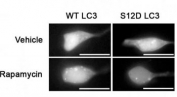 SH-SY5Y cells expressing GFP-LC3-WT or-S12D mutation (reduced puncta) treated with rapamycin or vehicle for 1h and probed with phospho-LC3C antibody