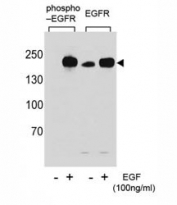 Western blot analysis of extracts from A431 cells,untreated or treated with EGF, using p-EGFR antibody (left) or nonphos Ab (right).