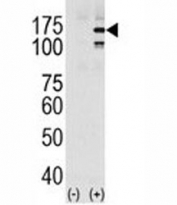 Western blot analysis of EGFR in HeLa cell lysate, either noninduced (Lane 1) or induced with EGF (2).