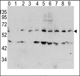 Western blot analysis of phospho c-Myc antibody and human TPA activated HeLa cells/lysate (0: without TPA; 1: 60ug/ml TPA-15min; 2: 60ug/ml-30min; 3: 60ug/ml-45min; 4: 125ug/ml-15min; 5: 125ug/ml-30min; 6: 125ug/ml-45min; 7: 250ug/ml-15min; 8: 250ug/ml-30min; 9: 250ug/ml-45min)~