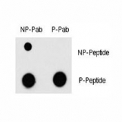 Dot blot analysis of phospho-MEF2C antibody and nonphos MEF2C Ab. 50ng of phos-peptide or nonphos-peptide per dot were spotted.