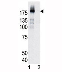 Western blot analysis of phospho-EGFR antibody and HeLa cell lysate, either induced (Lane 1) or noninduced with EGF (2).~