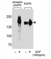 Western blot analysis of extracts from A431 cells, untreated or treated with EGF using phospho-EGFR antibody (left) or nonphos Ab (right).