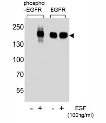 Western blot analysis of extracts from A431 cell, untreated or treated with EGF, using phospho-EGFR antibody (left) or nonphos Ab (right).~