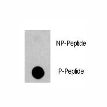 Dot blot analysis of phospho-EGFR antibody. 50ng of phos-peptide or nonphos-peptide per dot wer