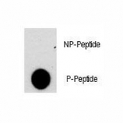 Dot blot analysis of phospho-NFATC2 antibody. 50ng of phos-peptide or nonphos-peptide per dot were spotted.