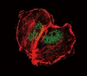 Confocal immunofluorescent analysis of phospho-Tuberin antibody with MCF-7 cells followed by Alexa Fluor 488-conjugated goat anti-rabbit lgG (green). Actin filaments have been labeled with Alexa Fluor 555 Phalloidin (red).