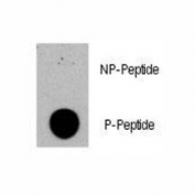 Dot blot analysis of phospho-TSC2 antibody. 50ng of phos-peptide or nonphos-peptide per dot were spotted.