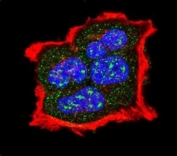 Confocal immunofluorescent analysis of phospho-TSC2 antibody with MCF-7 cells followed by Alexa Fluor 488-conjugated goat anti-rabbit lgG (green). Actin filaments have been labeled with Alexa Fluor 555 Phalloidin (red). DAPI was used as a nuclear counterstain (blue).