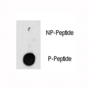 Dot blot analysis of phospho-ILK antibody. 50ng of phos-peptide or nonphos-peptide per dot were spotted.
