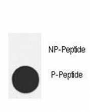 Dot blot analysis of p-MDM2 antibody. 50ng of phos-peptide or nonphos-peptide per dot were spotted.