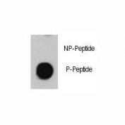 Dot blot analysis of phospho-ATM antibody. 50ng of phos-peptide or nonphos-peptide per dot were spotted.