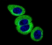 Confocal immunofluorescent analysis of phospho-ATM antibody with HeLa cells followed by Alexa Fluor 488-conjugated goat anti-rabbit lgG (green). DAPI was used as a nuclear counterstain (blue).