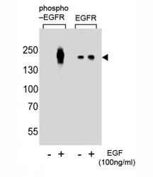 Western blot analysis of lysate from A431 cells (left to right), untreated or treated with EGF at 100ng/ml, using phospho-EGFR antibody (pY1016) or nonphos Ab at 1:8000 dilution.~