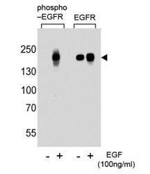 Western blot analysis of lysate from A431 cells (left to right), untreated or treated with EGF at 100ng/ml, using phospho-EGFR antibody (pS768) or nonphos Ab at 1:1000 dilution.~