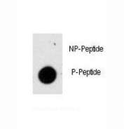 Dot blot analysis of phospho-GFAP antibody. 50ng of phos-peptide or nonphos-peptide per dot were spotted.