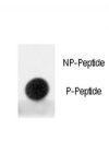 Dot blot analysis of phospho-MDM2 antibody. 50ng of phos-peptide or nonphos-peptide per dot were spotted.