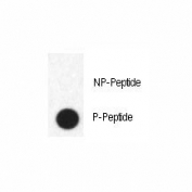 Dot blot analysis of phospho-FABP4 antibody. 50ng of phos-peptide or nonphos-peptide per dot were spotted.