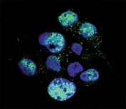Confocal immunofluorescent analysis of phospho-eNos antibody with HepG2 cells followed by Alexa Fluor 488-conjugated goat anti-rabbit lgG (green). DAPI was used as a nuclear counterstain (blue).