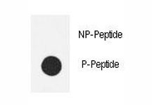 Dot blot analysis of phospho-eNos antibody. 50ng of phos-peptide or nonphos-peptide per dot were spotted.~