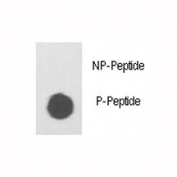 Dot blot analysis of phospho ILK antibody. 50ng of phos-peptide or nonphos-peptide per dot were spotted.