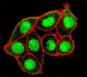 Confocal immunofluorescent analysis of phospho-MUC1 antibody and HeLa cells followed by Alexa Fluor 488-conjugated goat anti-rabbit lgG (green). Actin filaments have been labeled with Alexa Fluor 555 Phalloidin (red).