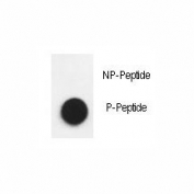 Dot blot analysis of phospho-Nephrin antibody. 50ng of phos-peptide or nonphos-peptide per dot were spotted.