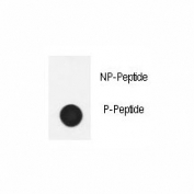 Dot blot analysis of phospho-Nephrin antibody. 50ng of phos-peptide or nonphos-peptide per dot were spotted.