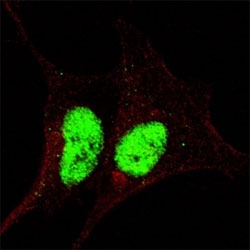 Fluorescent confocal image of SY5Y cells stained with phospho-Sox2 antibody at 1:200. The immunosignal is localized to the nucleus.~