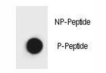 Dot blot analysis of phospho Beclin 1 antibody. 50ng of phos-peptide or nonphos-peptide per dot were spotted.