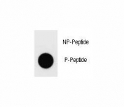 Dot blot analysis of phospho-Dnmt1 antibody. 50ng of phos-peptide or nonphos-peptide per dot were spotted.