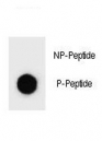 Dot blot analysis of p-HER2 antibody. 50ng of phos-peptide or nonphos-peptide per dot were spotted.